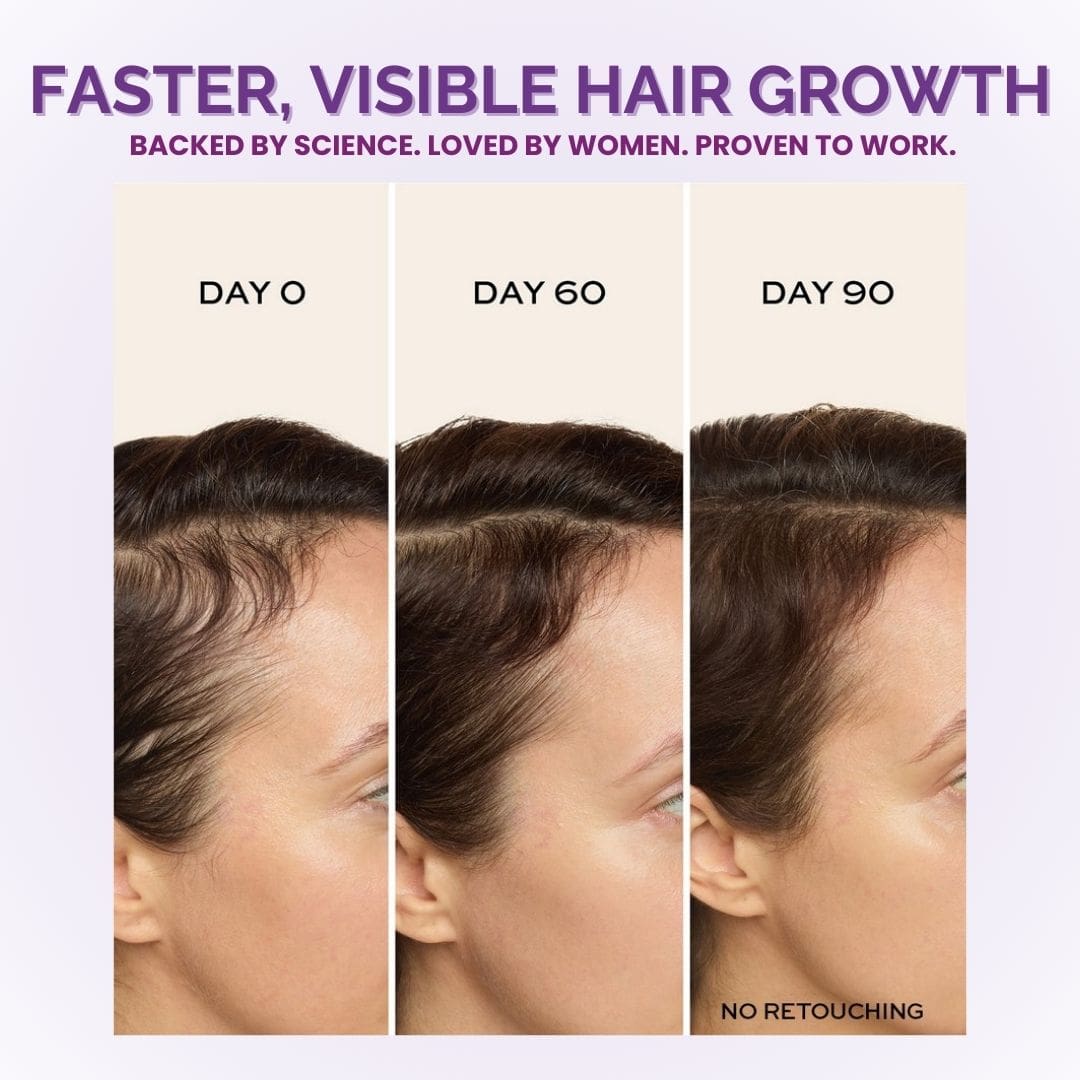 Hi Nourish™ Hair Growth Accelerator - 10,000mcg Biotin + Lustriva Complex