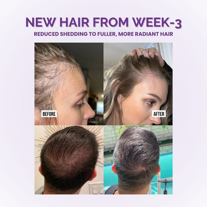 Hi Nourish™ Hair Growth Accelerator - 10,000mcg Biotin + Lustriva Complex